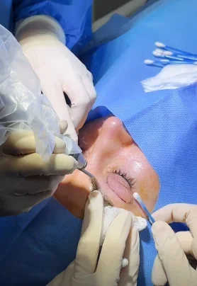 Equipe do HNolhos realizando procedimento ocular